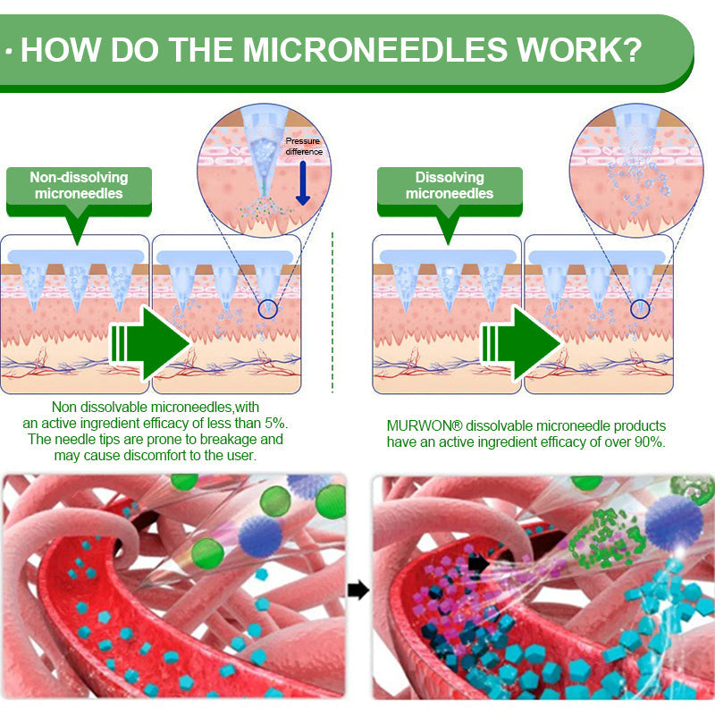 𝐀𝐮𝐬𝐬𝐢𝐞 𝐃𝐨𝐜𝐭𝐨𝐫 𝐑𝐞𝐜𝐨𝐦𝐦𝐞𝐧𝐝𝐞𝐝 👨‍⚕️ |🏆🏆 𝑴𝑼𝑹𝑾𝑶𝑵® 𝗕𝗲𝗿𝗯𝗲𝗿𝗶𝗻𝗲 𝟏𝟎-𝐢𝐧-𝟏 𝗡𝗮𝗻𝗼 𝗠𝗶𝗰𝗿𝗼𝗻𝗲𝗲𝗱𝗹𝗲 𝗣𝗮𝘁𝗰𝗵 | 𝐴𝑑𝑣𝑎𝑛𝑐𝑒𝑑 10-𝑖𝑛-1 𝑓𝑜𝑟𝑚𝑢𝑙𝑎 | ✅ 𝑉𝑖𝑠𝑖𝑏𝑙𝑒 𝑟𝑒𝑠𝑢𝑙𝑡𝑠 𝑖𝑛 𝑎𝑠 𝑙𝑖𝑡𝑡𝑙𝑒 𝑎𝑠 7 𝑑𝑎𝑦𝑠 🏮